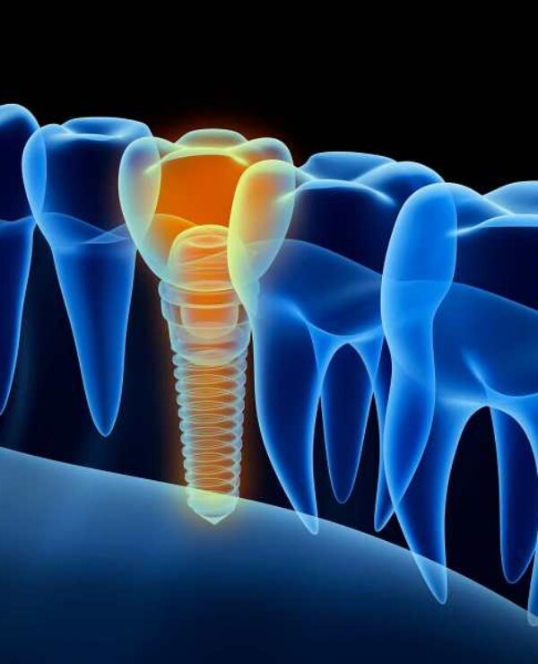 Treatment - Morrison Dental