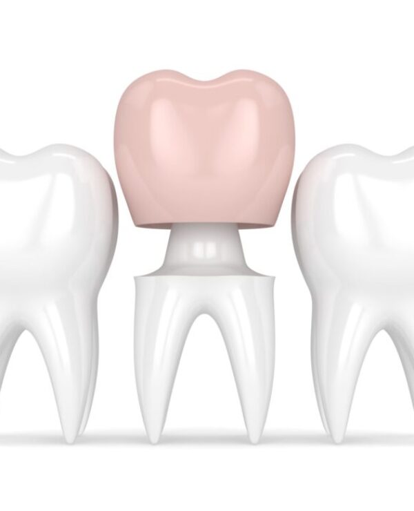 Treatment - Morrison Dental