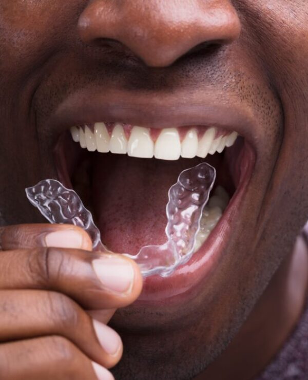 Treatment - Morrison Dental