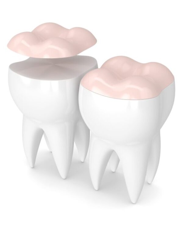 Treatment - Morrison Dental